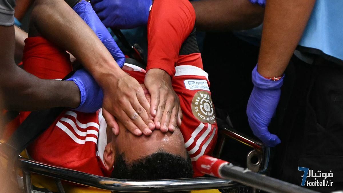 شوک بزرگ به بایرن مونیخ؛ مصدومیت وحشتناک جمال موسیالا و شکستگی مچ پا مقابل پاری سن ژرمن