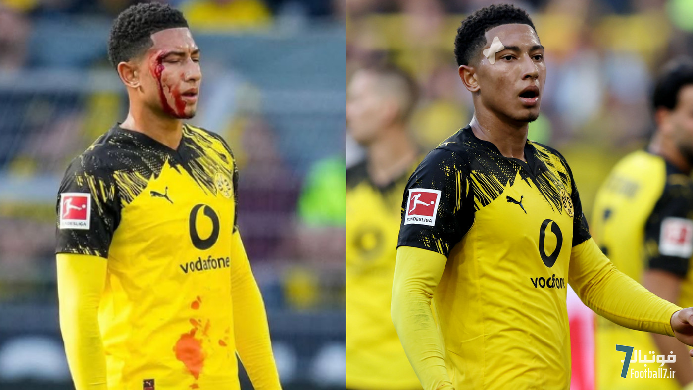 سر خونین جوب بلینگام در اولین برد دورتموند در بوندس‌لیگا مقابل یونیون برلین