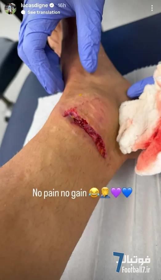 مچ پای لوکا دینیه پس از تکل خشن: مصدومیت وحشتناک و فریاد خشم ستاره استون ویلا به داوری
